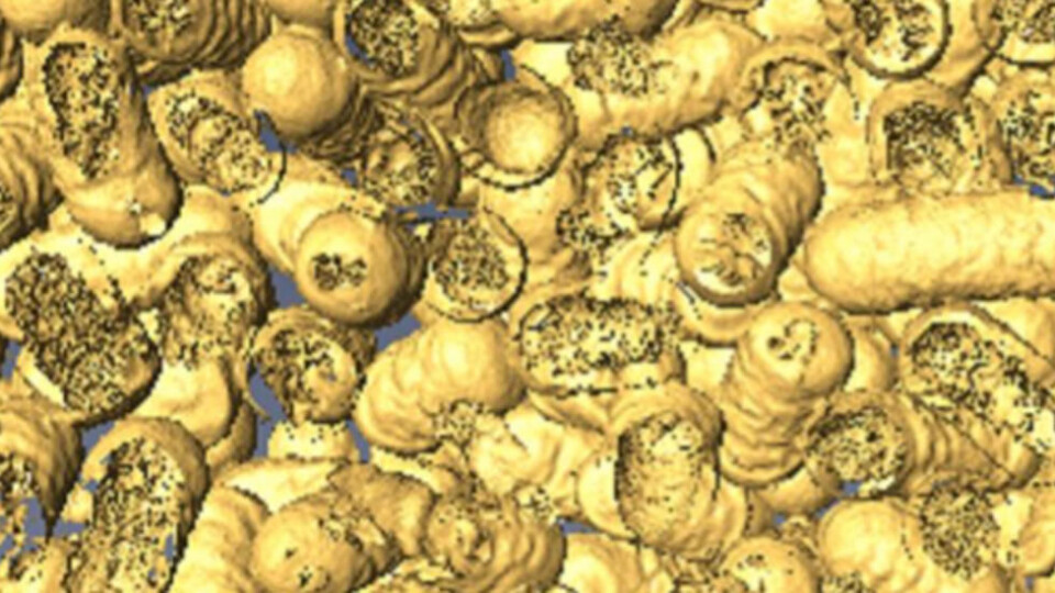 Døde bakterier som har blitt spist av nanoenzymer. (Foto: Dr Chaitali Dekiwadia/ RMIT universitet i Melbourne) Døde bakterier som har blitt spist av nanoenzymer. (Foto: Dr Chaitali Dekiwadia/ RMIT universitet i Melbourne)