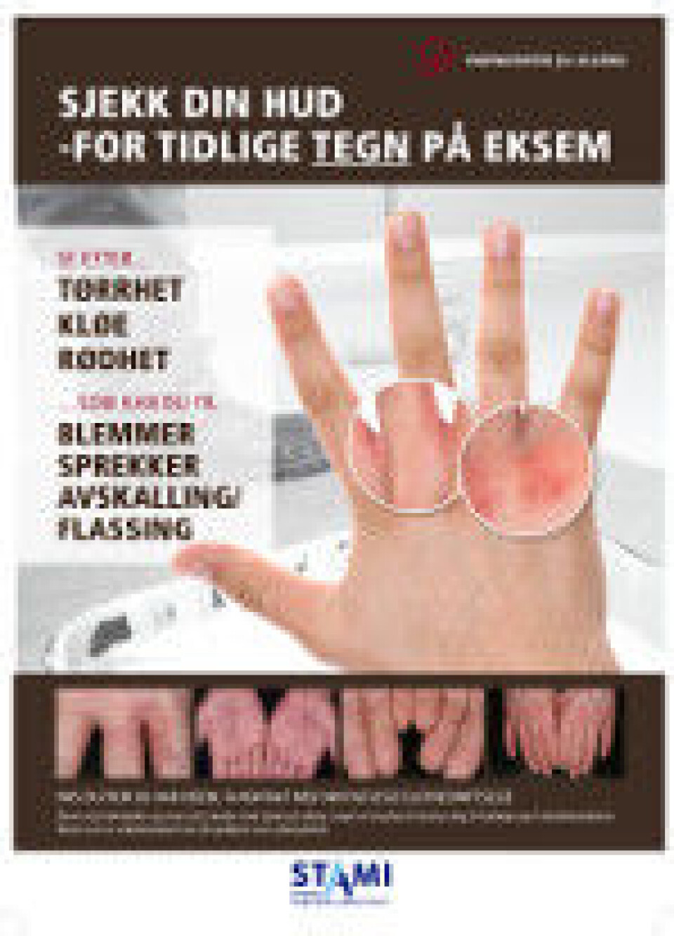Poster. (Videncenter for Allergi) Poster. (Videncenter for Allergi)